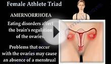 Female Athlete Triad - Everything You Need To Know - Dr